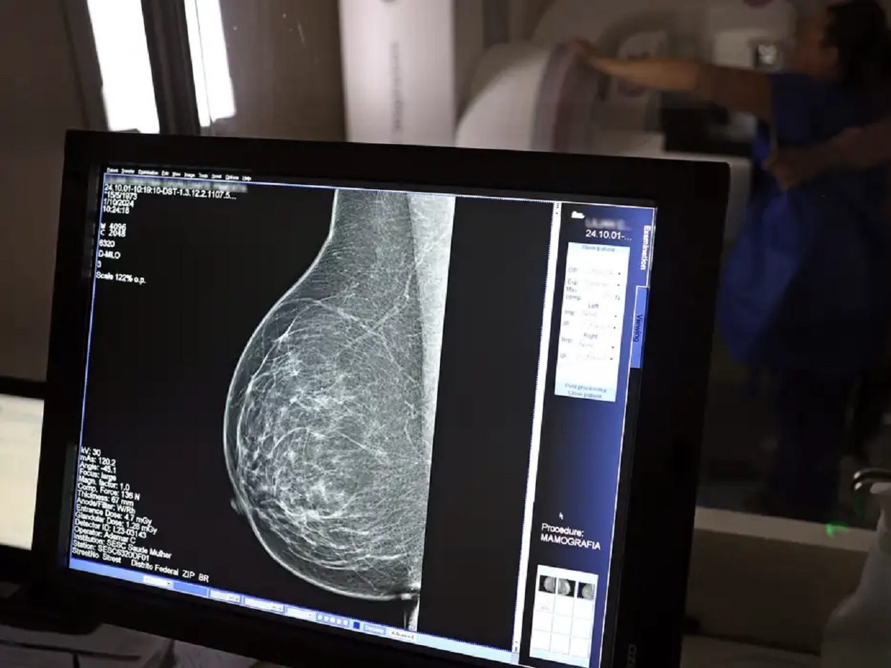 mamografia exame josé cruz agência Brasil