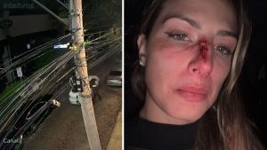 Mulher sofre agressão ao deixar bar no Cambuí; vítima relata fratura no nariz (Foto: arquivo pessoal)