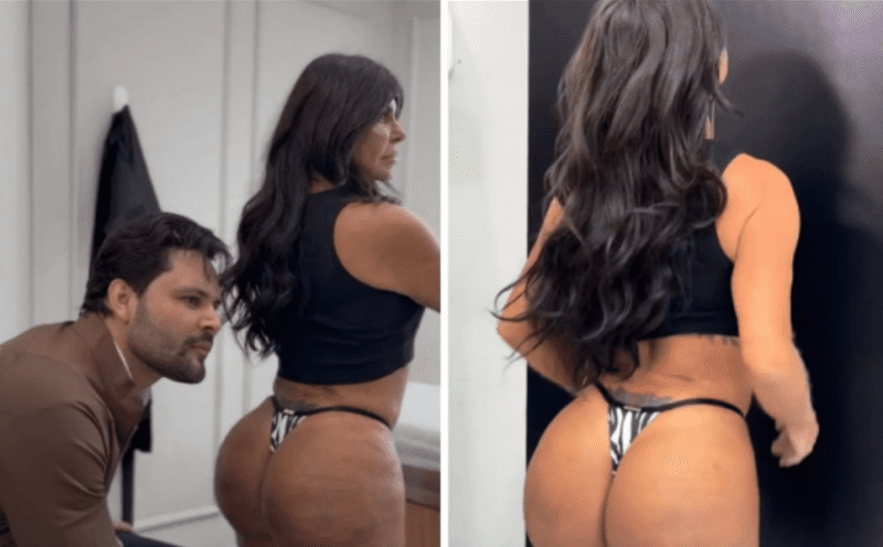 Gretchen rebate críticas relacionadas a novos procedimentos