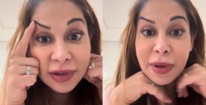 Maíra Cardi fica com sobrancelha torta após erro no procedimento estético