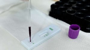 Teste rápido para HIV com aplicação de amostra de sangue