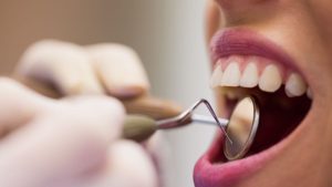 Mulheres vitimas de violência terão reconstrução dentária