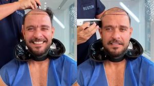 Digo Nogueira raspa a cabeça e intriga fãs