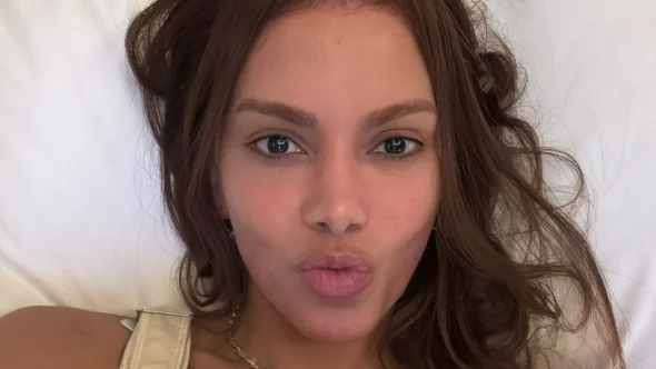 Antes e depois do rosto da Anitta