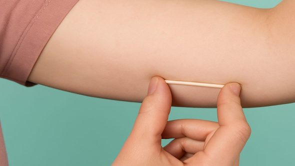 Implante anticoncepcional oferecido pelo SUS a partir de 2025