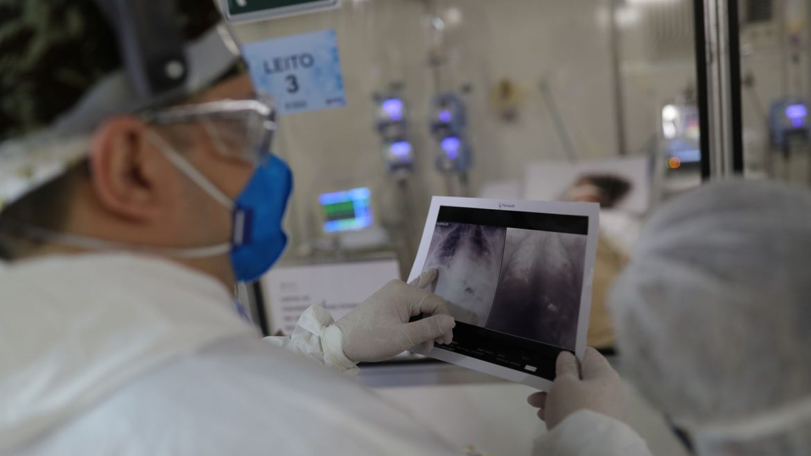 radiografia_de_torax_coronaviruscovid-19_hospital_sao_paulo1205200326